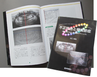 写真:「不正咬合と顎関節症」医学情報社